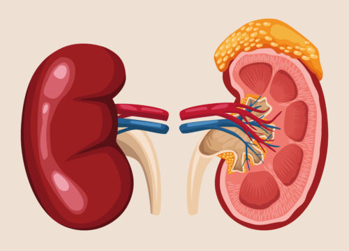 Homoeopathy and Kidney Failure: Can It Help People on Dialysis?